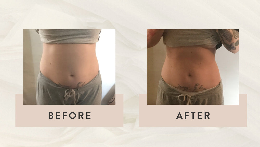 Before & After Arrae Bloat
