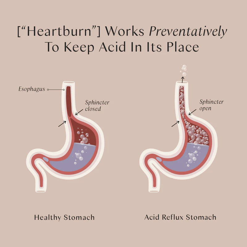 Acid reflux vs healthy stomach diagram 