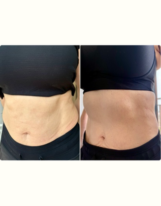 Bloat Before/After