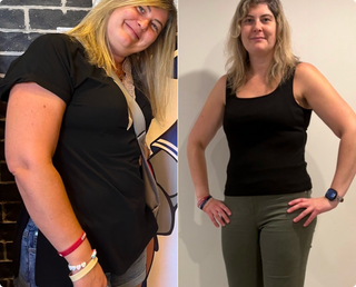 MB-1 Max Before/After