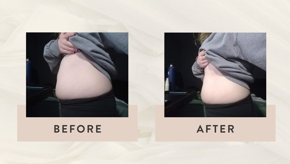 Before & After Arrae Bloat