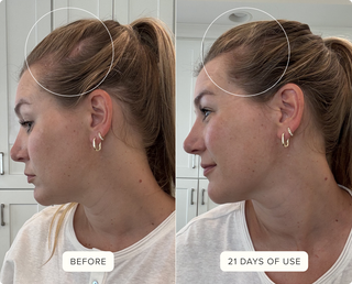Before & After Hair Protein