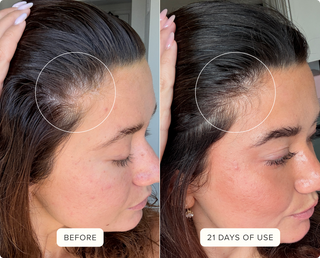 Before & After Hair Protein