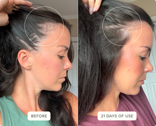 Before & After Hair Protein
