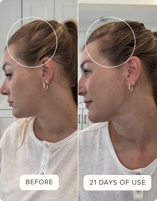 Before & After Hair Protein