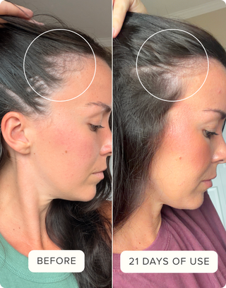 Before & After Hair Protein