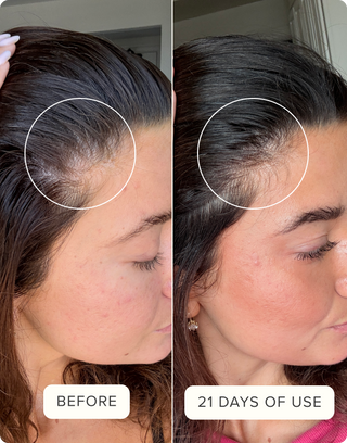 Before & After Hair Protein